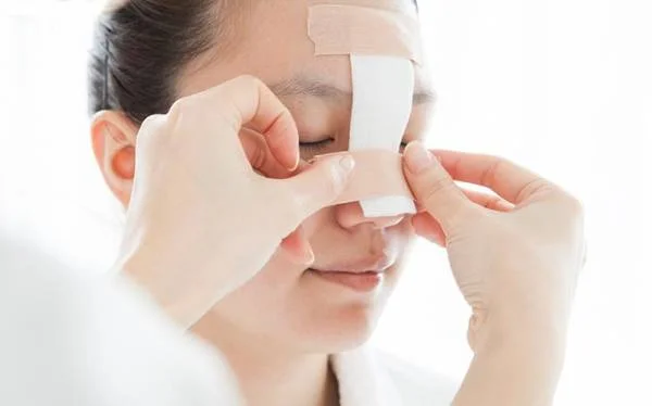 آیا بعد از جراحی بینی می‌توان مسواک زد؟