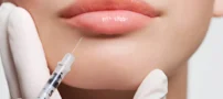 تزریق ژل لب روسی مناسب چه فرم صورتی است؟ (راهنمای انتخاب هوشمندانه)