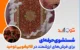 نحوه تمیز کردن مایه کیک شکلاتی خشک شده روی فرش